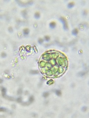 Sphaerocystis