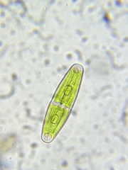 Closterium navicula