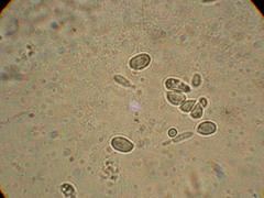 Clavariadelphus americanus