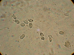 Clavariadelphus americanus