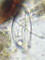 Cymbella