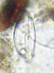 Cymbella