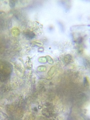Oocystis