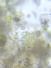 Oocystis