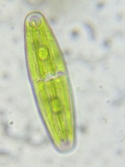 Closterium navicula