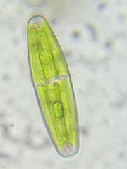 Closterium navicula