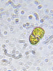 Cosmarium formosulum