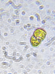 Cosmarium formosulum