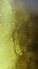 Hemitrichia calyculata