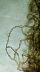 Hemitrichia calyculata