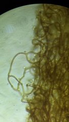 Hemitrichia calyculata