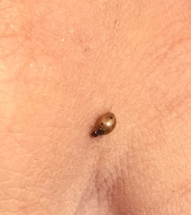 Exochomus quadriplagiatus