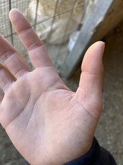 Dermanyssus gallinae