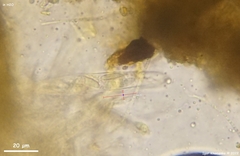 Dermea prunastri