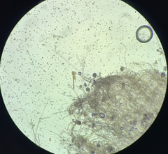 Mucoromycota