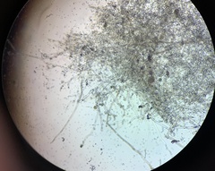 Mucoromycota