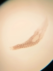 Dendrocoelum lacteum