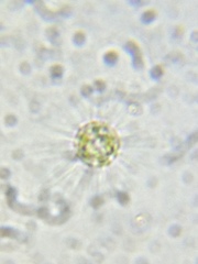 Heliozoa