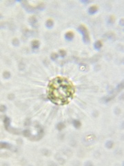 Heliozoa
