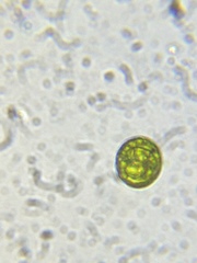 Chlorococcum