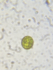 Chlorococcum