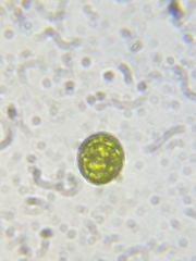 Chlorococcum