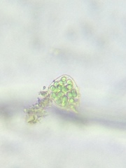 Coelosphaerium aerugineum