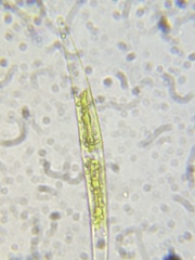 Closterium acerosum