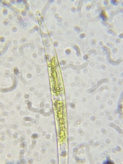 Closterium acerosum