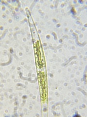 Closterium acerosum