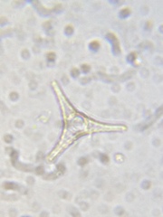 Staurastrum anatinum