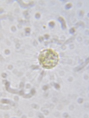 Heliozoa