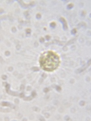 Heliozoa