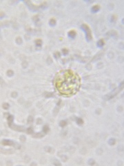 Heliozoa