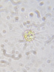 Heliozoa