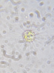 Heliozoa