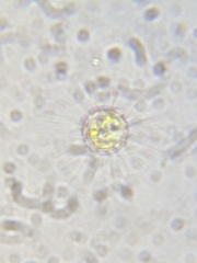 Heliozoa