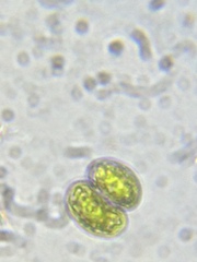 Cosmarium contractum