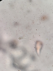Amoebidae