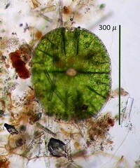 Micrasterias denticulata