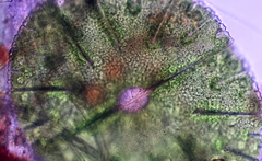 Micrasterias denticulata