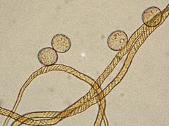 Trichia crateriformis