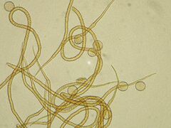 Trichia crateriformis