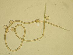 Trichia crateriformis