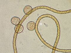 Trichia crateriformis