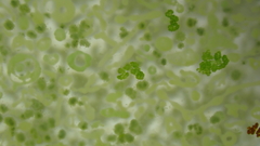 Gloeotrichia echinulata