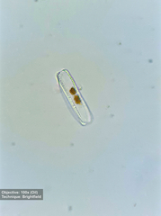 Bacillariophyceae