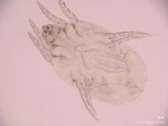 Dermatophagoides