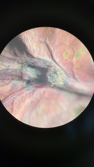 Andricus quercusutriculus