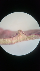 Andricus quercusutriculus